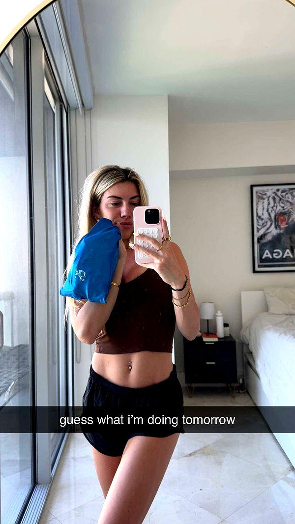 bellarenaldii image ~ Altpins