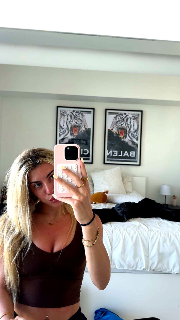 bellarenaldii image ~ Altpins