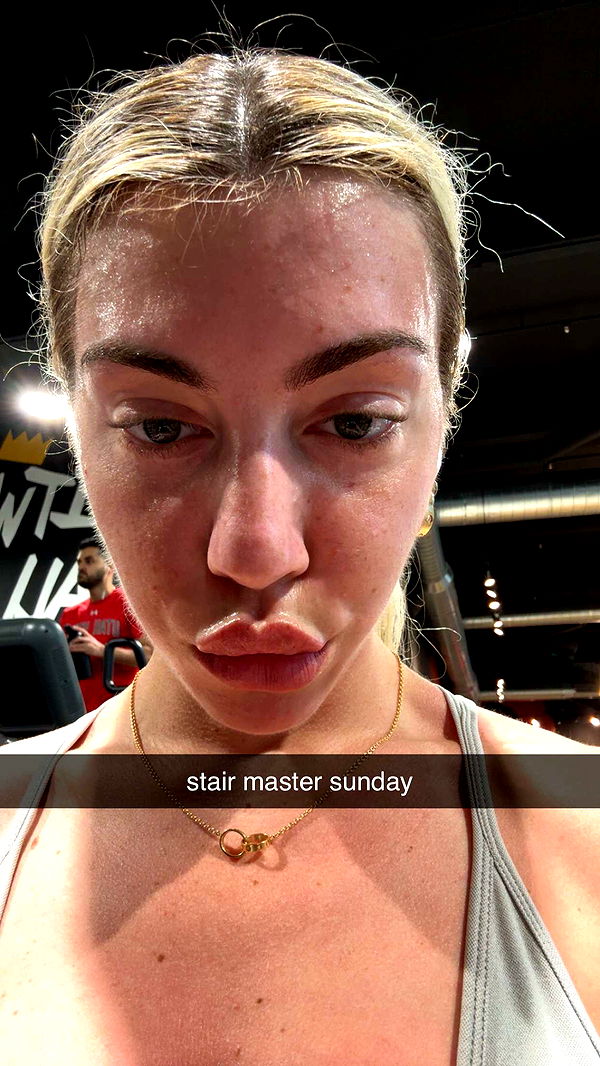 bellarenaldii image ~ Altpins