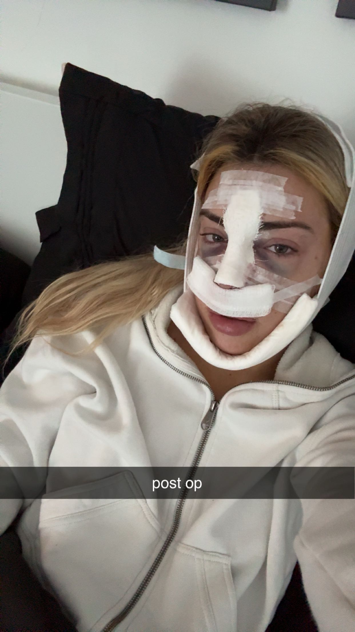 bellarenaldii snapchat image archive image