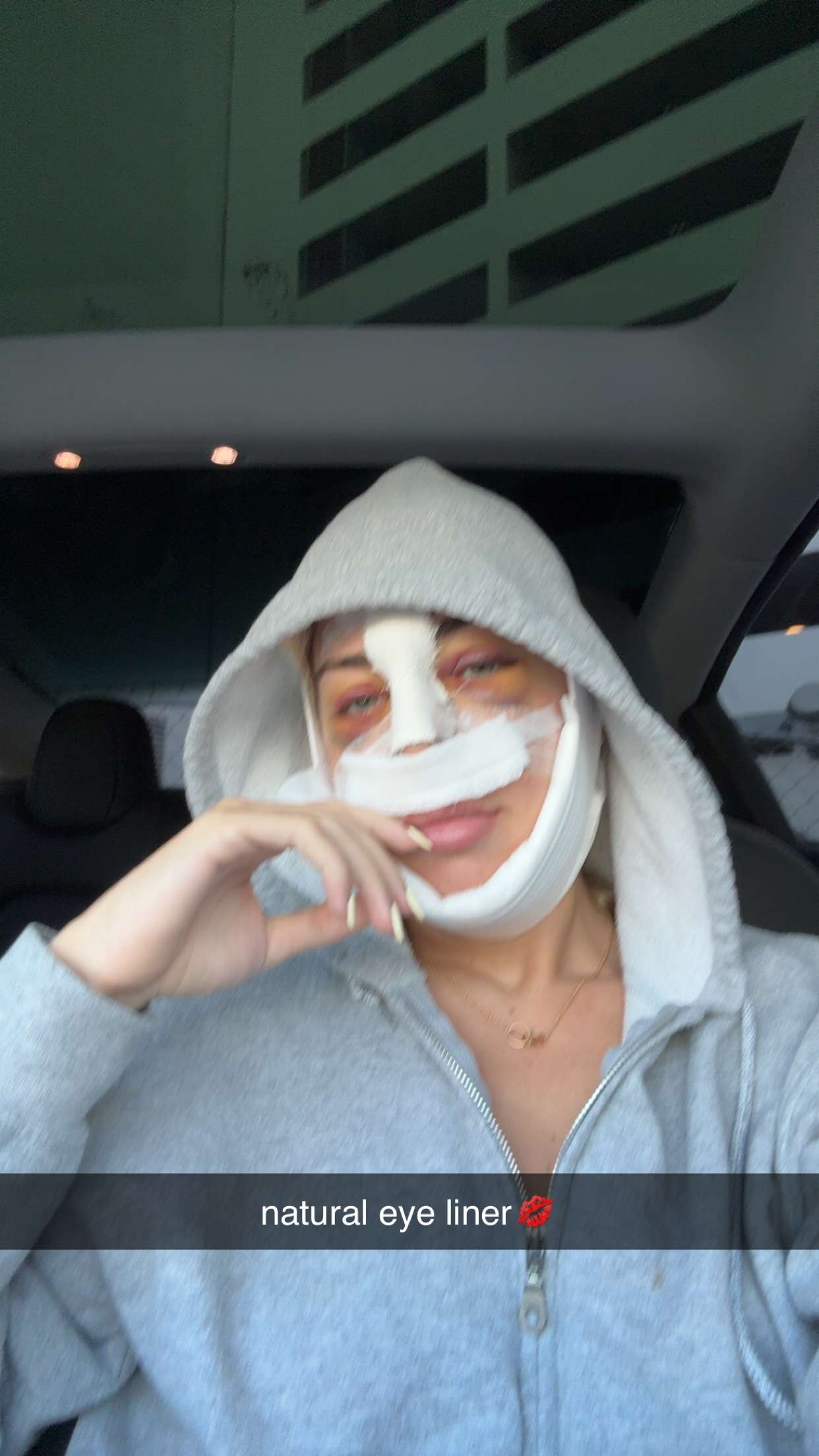 bellarenaldii snapchat image archive image