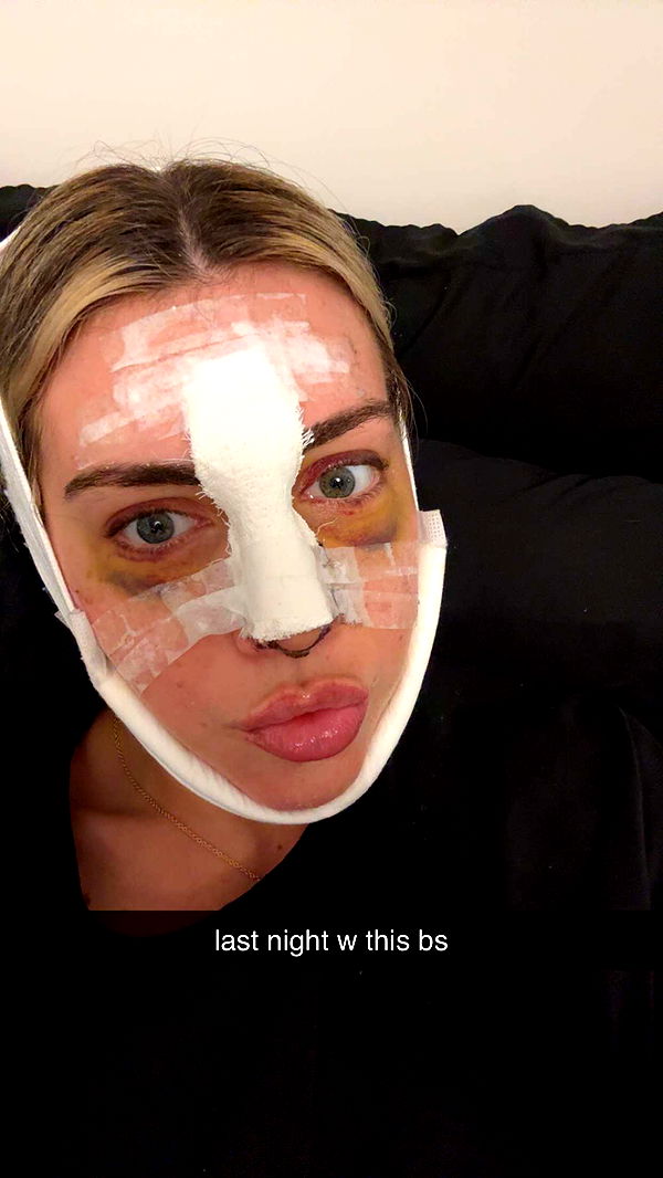 bellarenaldii image ~ Altpins