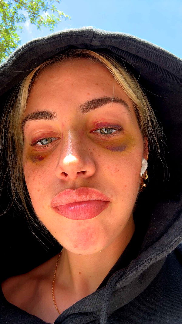 bellarenaldii image ~ Altpins