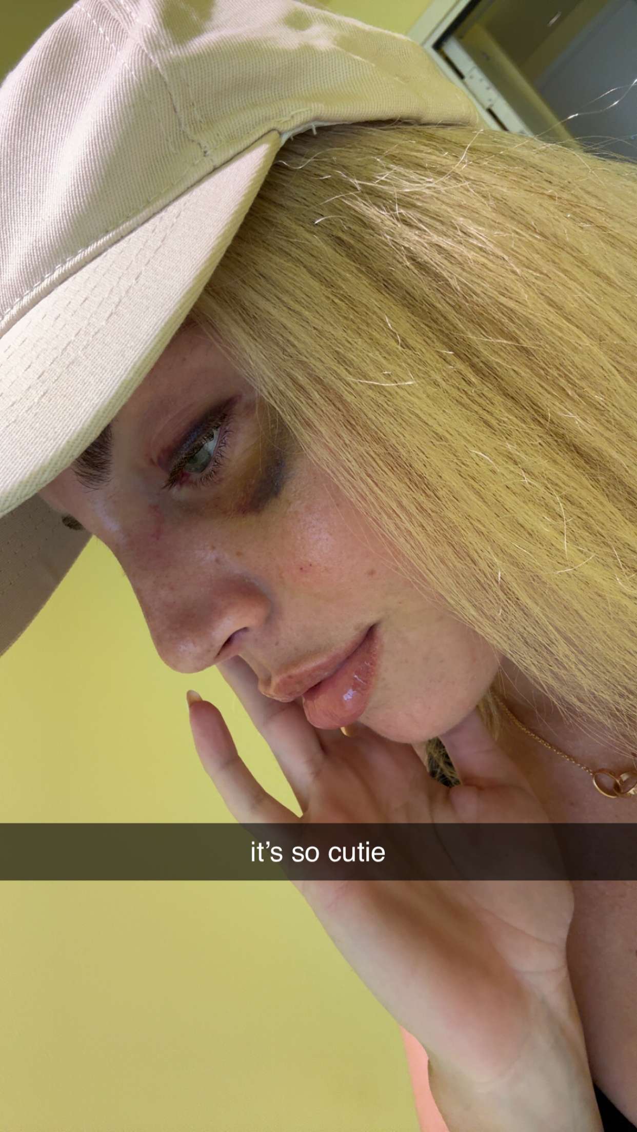 bellarenaldii snapchat image archive image