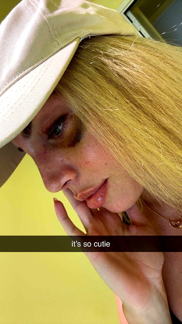 bellarenaldii image ~ Altpins