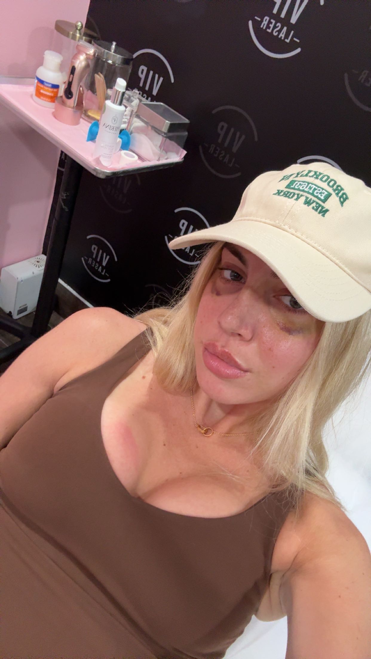 bellarenaldii snapchat image archive image