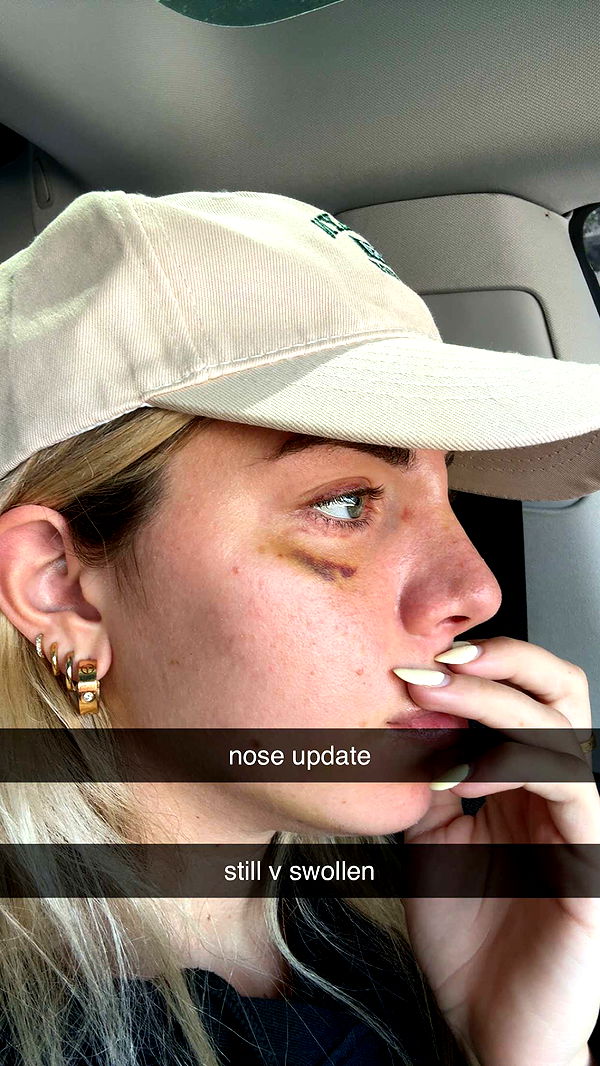 bellarenaldii image ~ Altpins