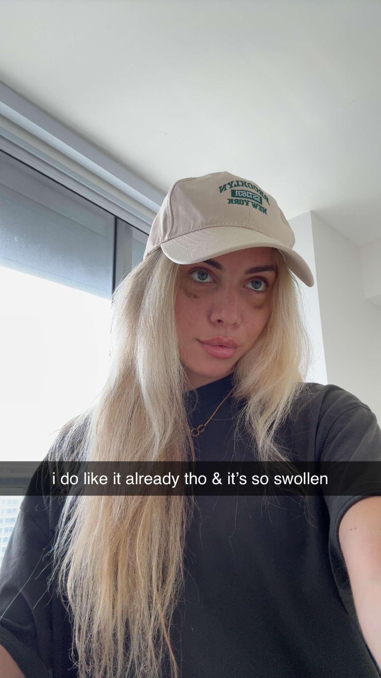 bellarenaldii snapchat image archive image