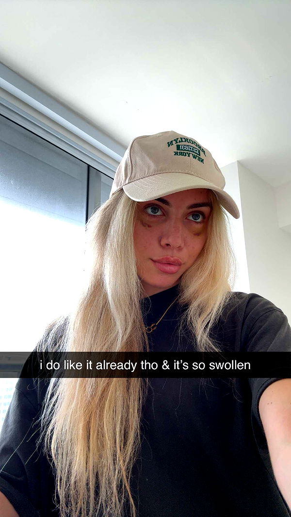 bellarenaldii image ~ Altpins