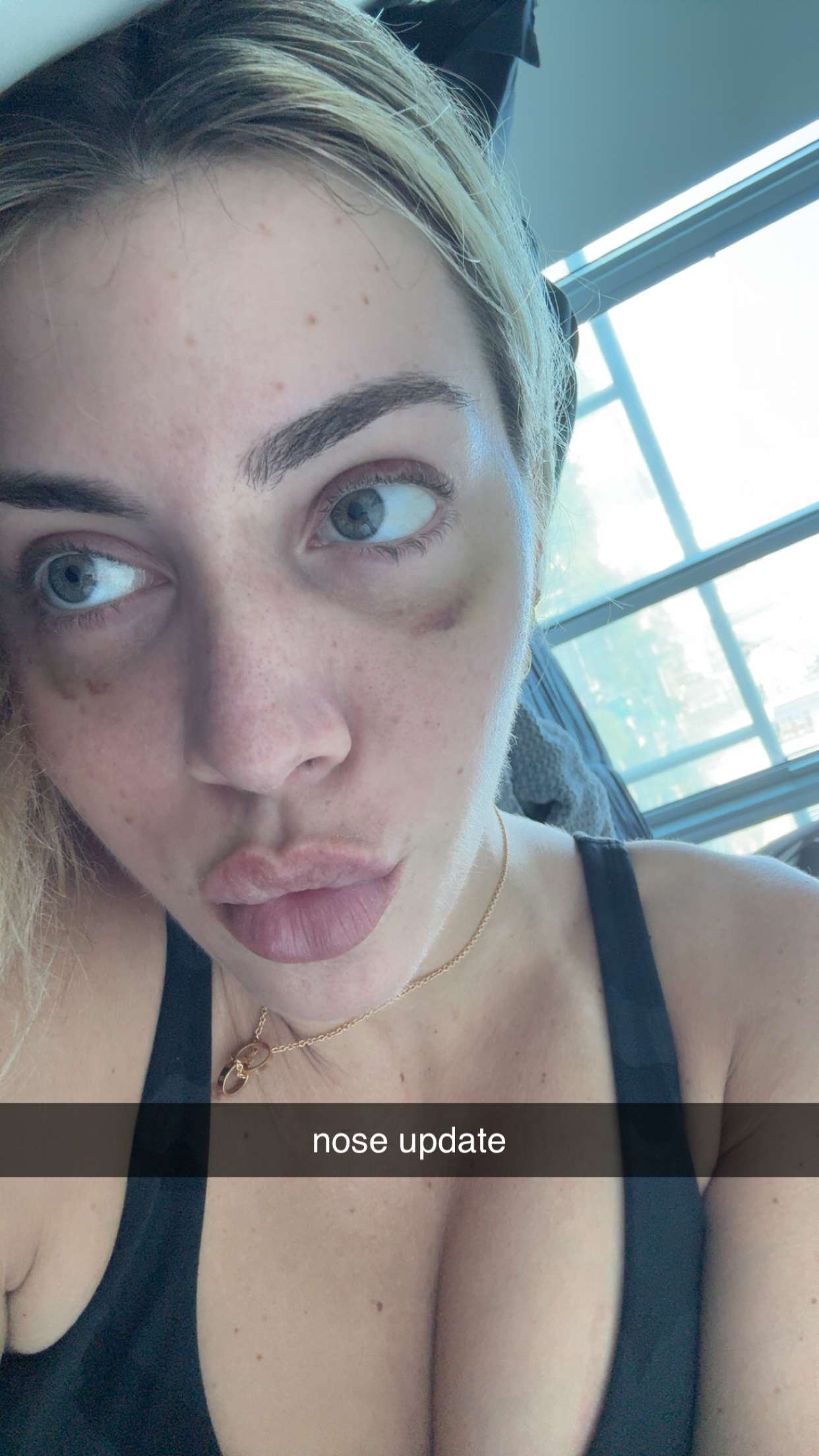 bellarenaldii snapchat image archive image