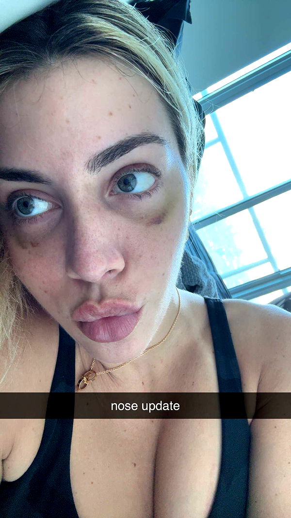 bellarenaldii image ~ Altpins