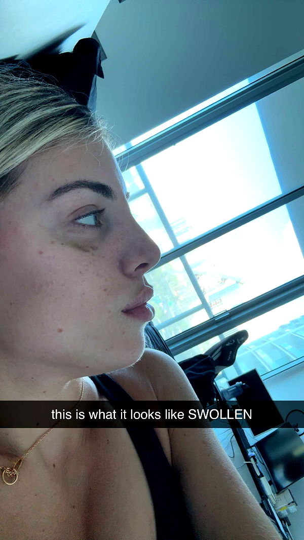 bellarenaldii image ~ Altpins