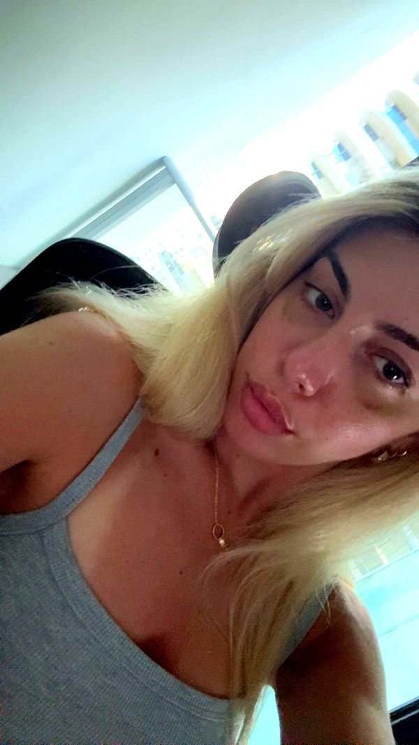 bellarenaldii image ~ Altpins