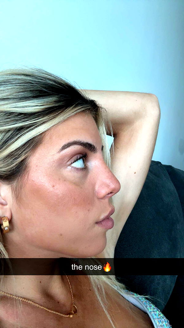 bellarenaldii image ~ Altpins