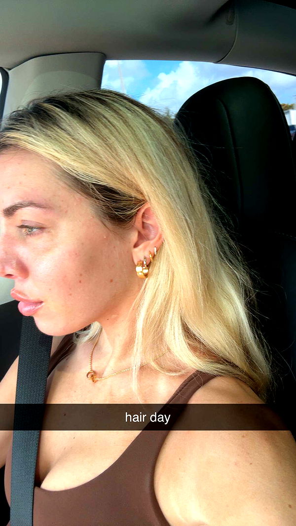 bellarenaldii image ~ Altpins