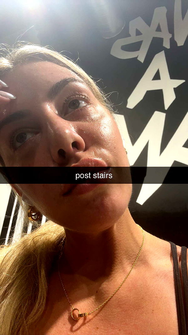 bellarenaldii image ~ Altpins