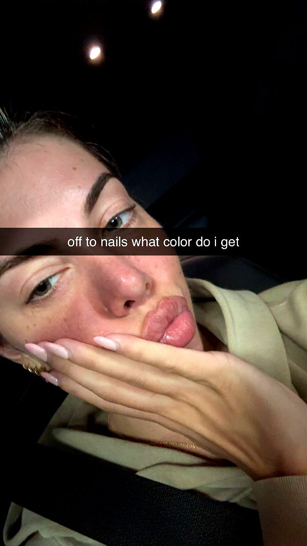 bellarenaldii image ~ Altpins