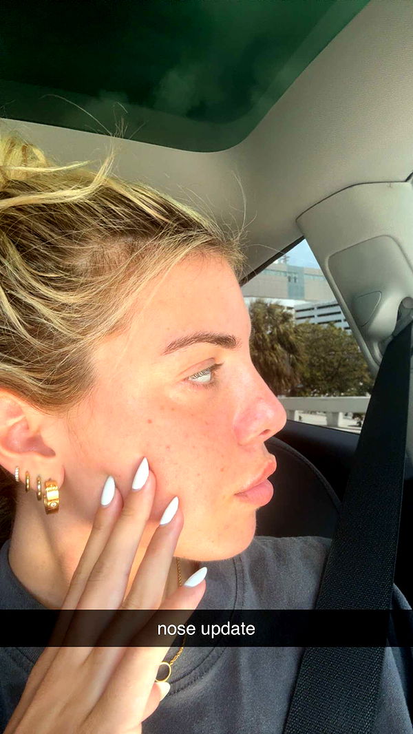 bellarenaldii image ~ Altpins