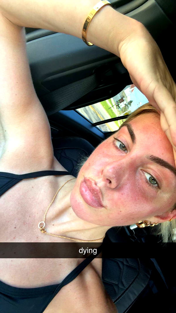 bellarenaldii image ~ Altpins