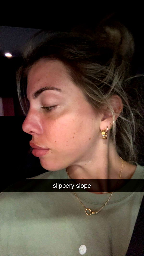 bellarenaldii image ~ Altpins