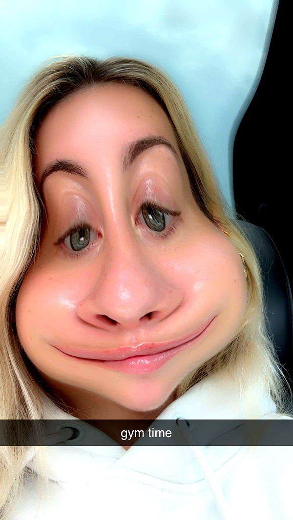 bellarenaldii image ~ Altpins