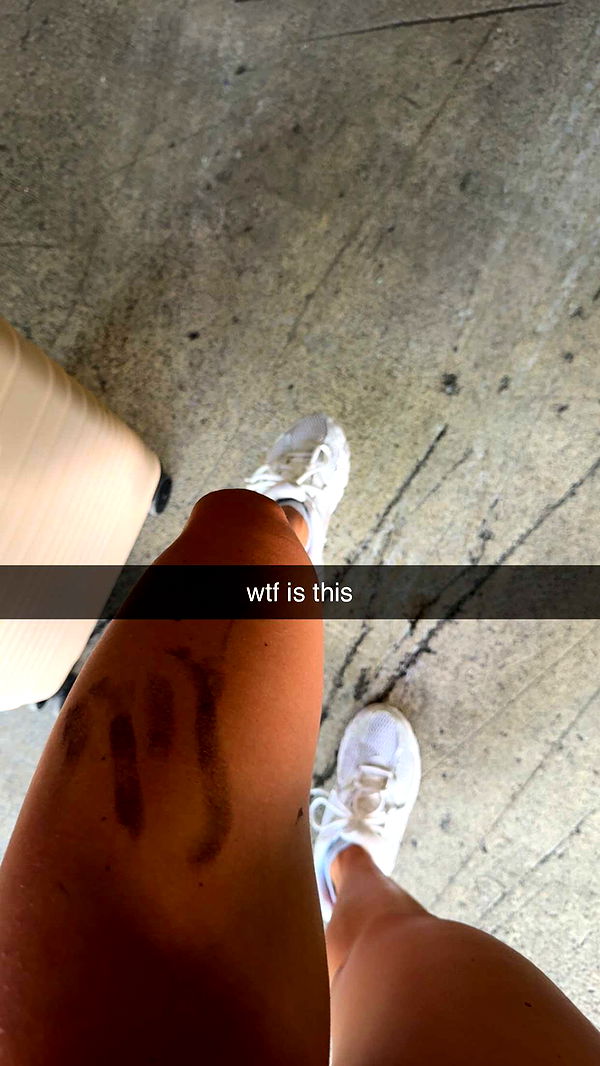 bellarenaldii image ~ Altpins