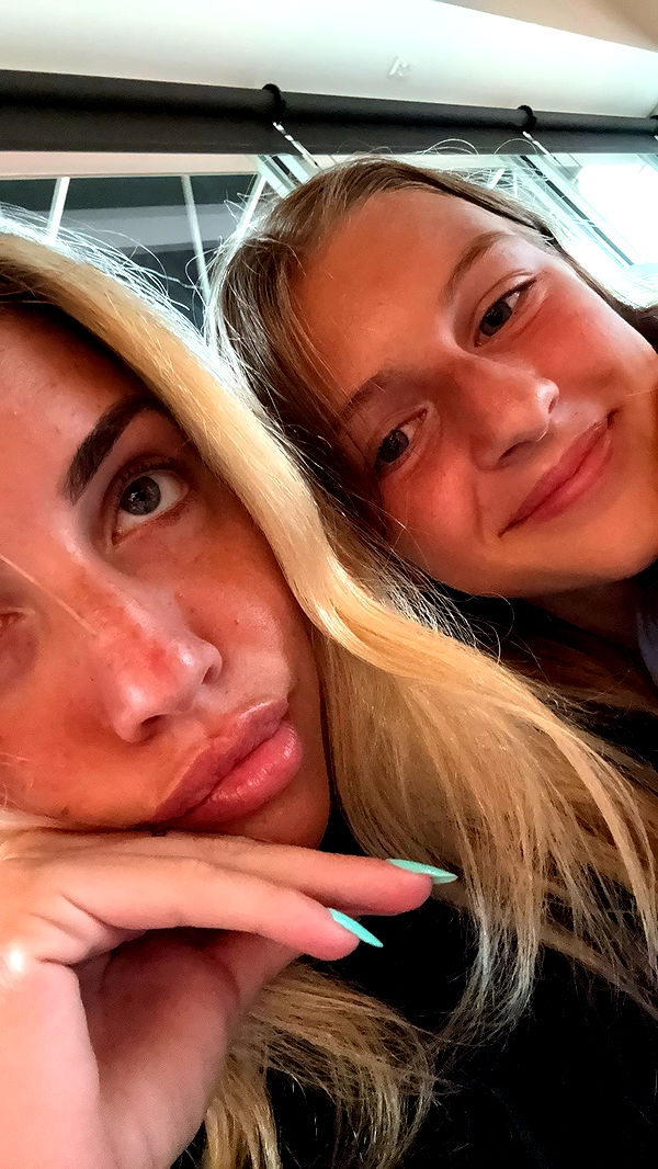 bellarenaldii image ~ Altpins