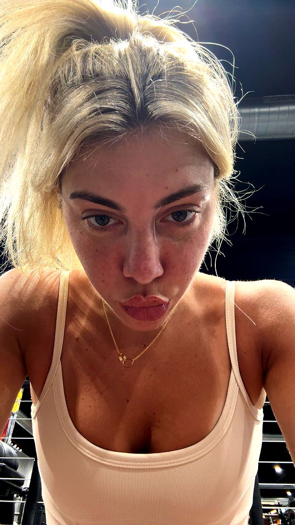 bellarenaldii image ~ Altpins