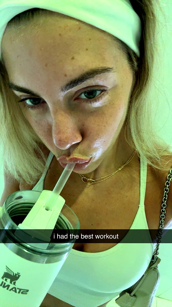 bellarenaldii image ~ Altpins