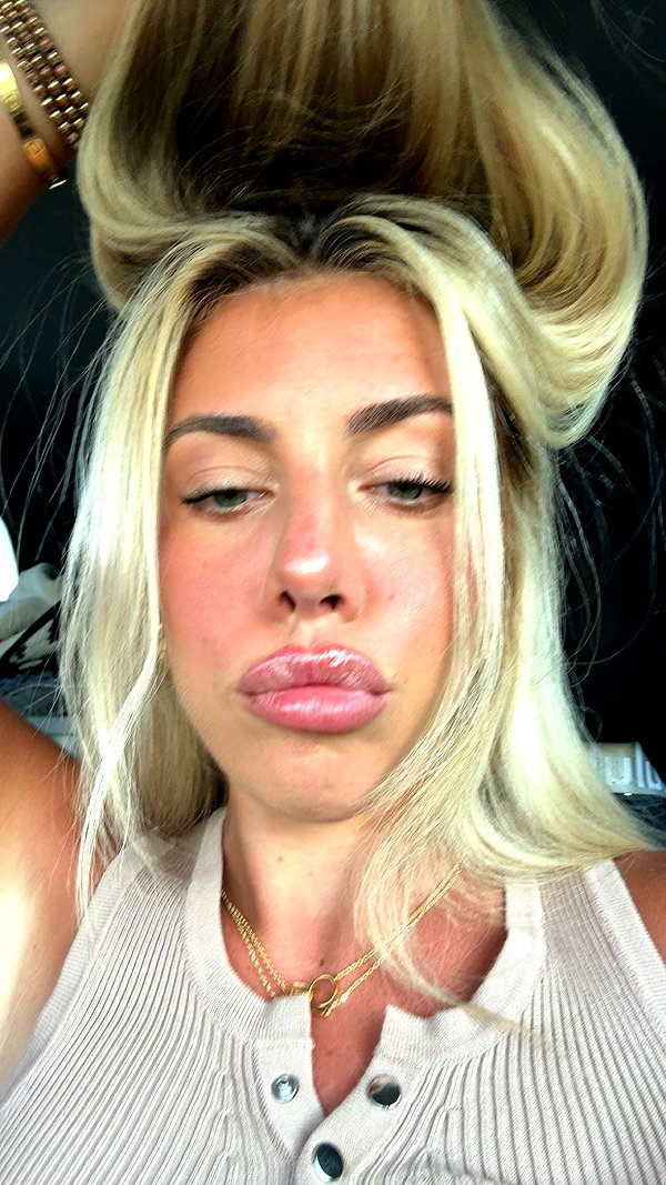 bellarenaldii snapchat image archive image