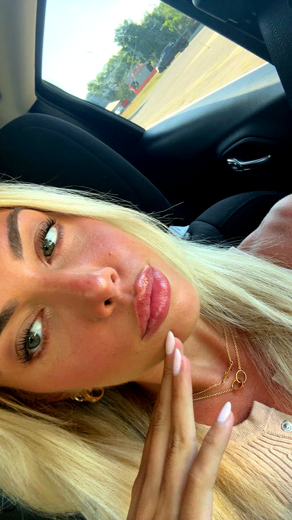 bellarenaldii snapchat image archive image