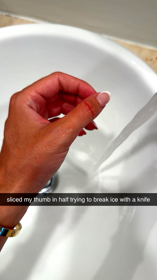 bellarenaldii snapchat image archive image