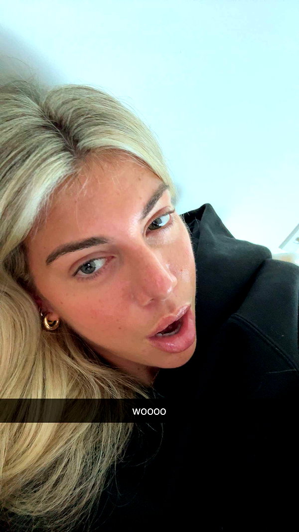bellarenaldii snapchat image archive image