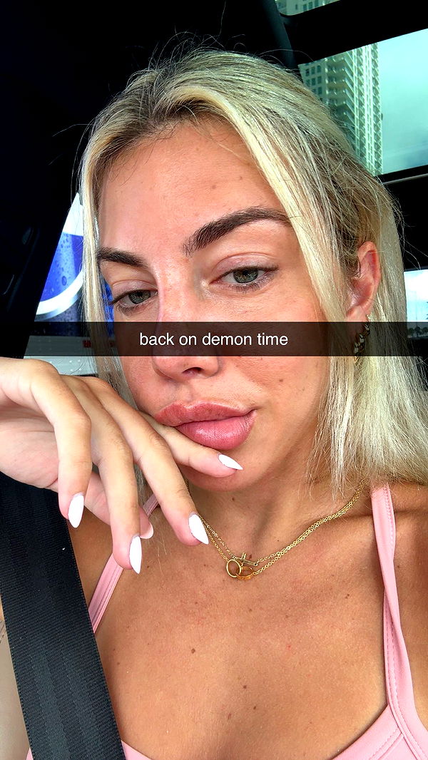 bellarenaldii image ~ Altpins