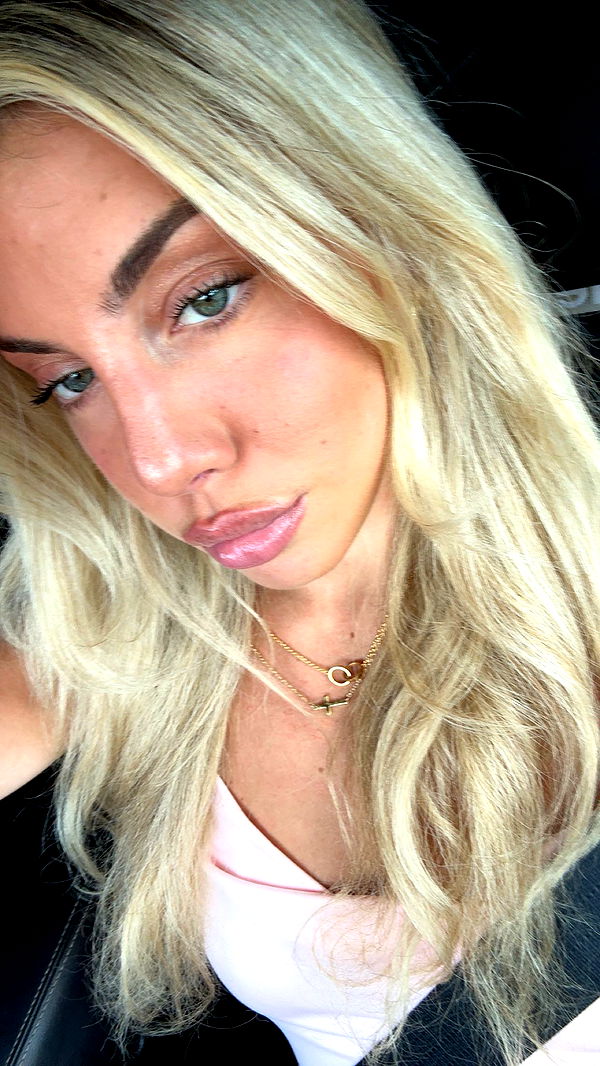 bellarenaldii image ~ Altpins