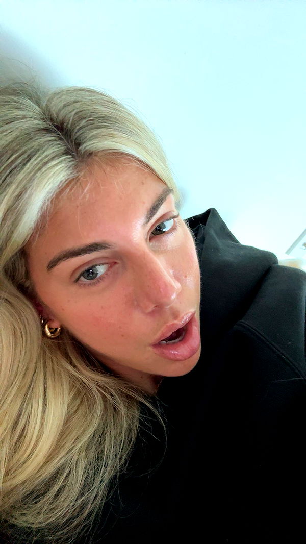 bellarenaldii image ~ Altpins