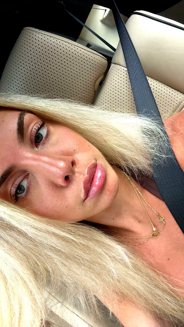 bellarenaldii image ~ Altpins