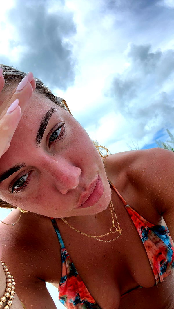 bellarenaldii image ~ Altpins