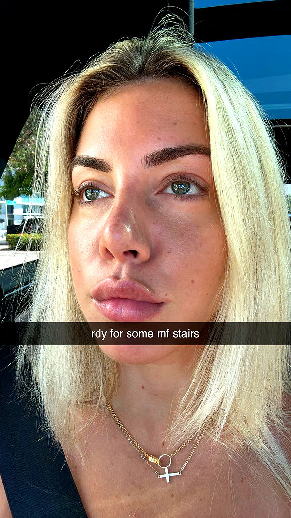 bellarenaldii image ~ Altpins