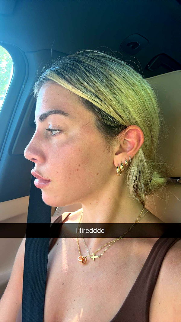 bellarenaldii image ~ Altpins