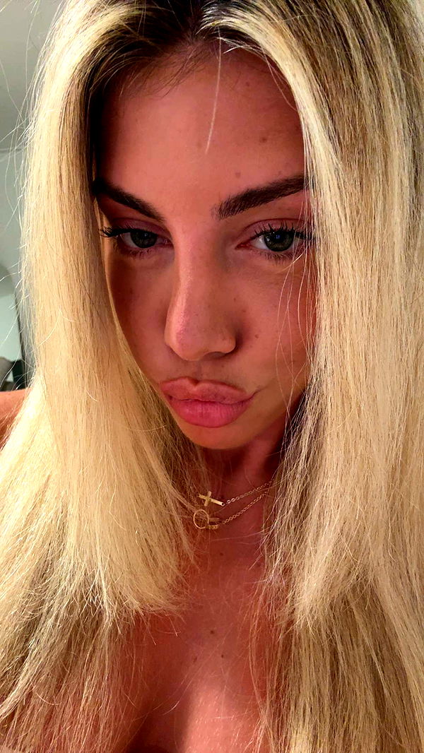 bellarenaldii image ~ Altpins