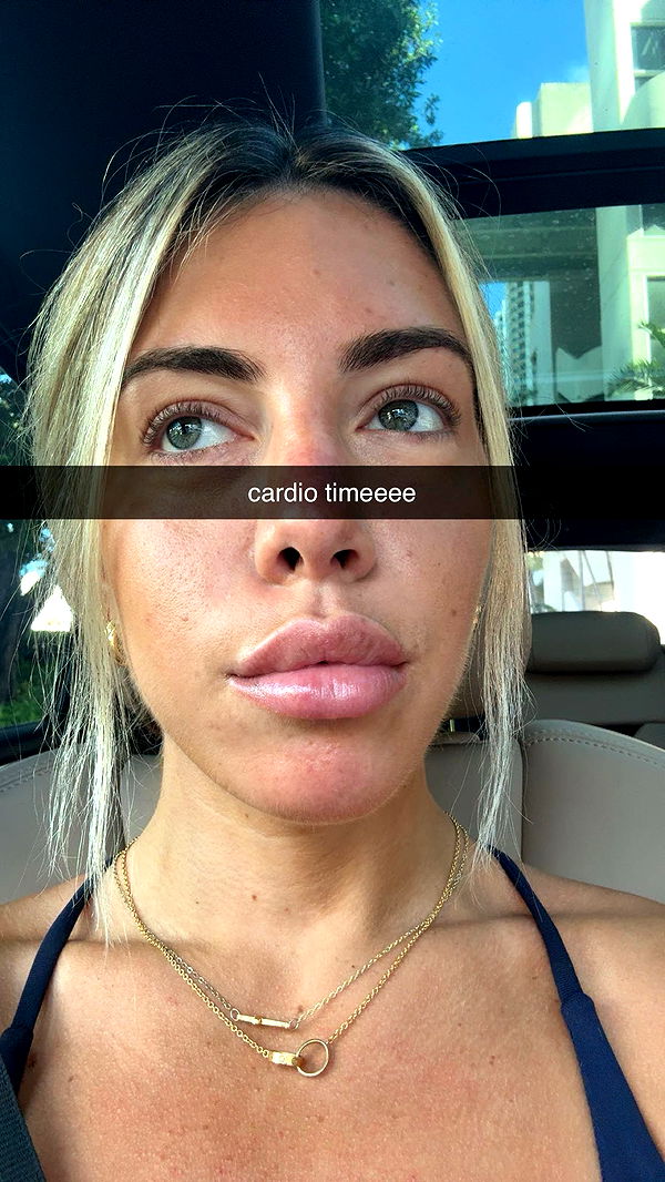 bellarenaldii image ~ Altpins