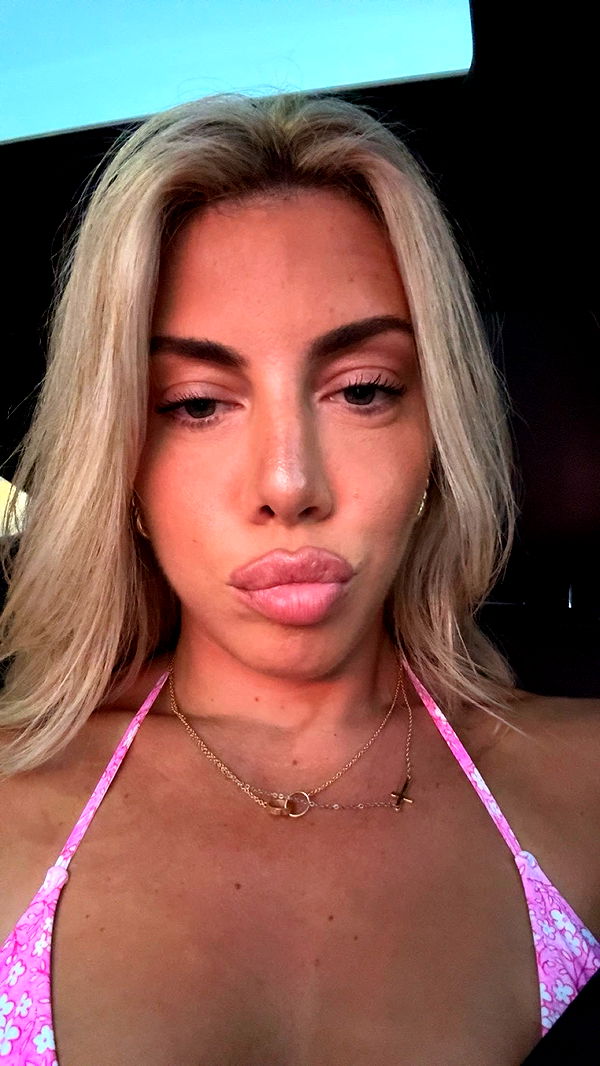 bellarenaldii image ~ Altpins