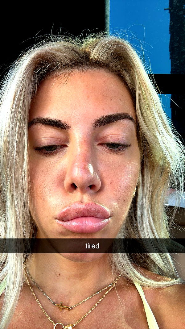 bellarenaldii image ~ Altpins