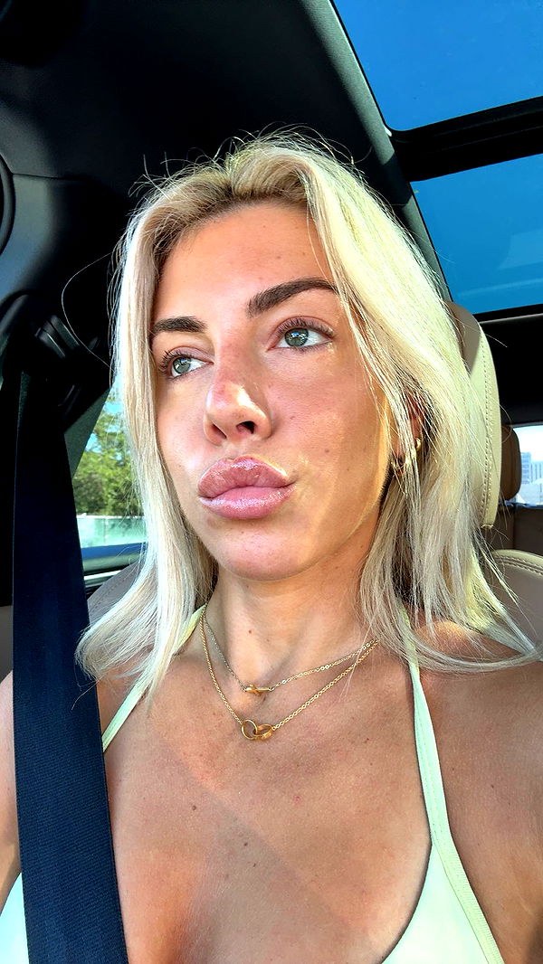 bellarenaldii image ~ Altpins