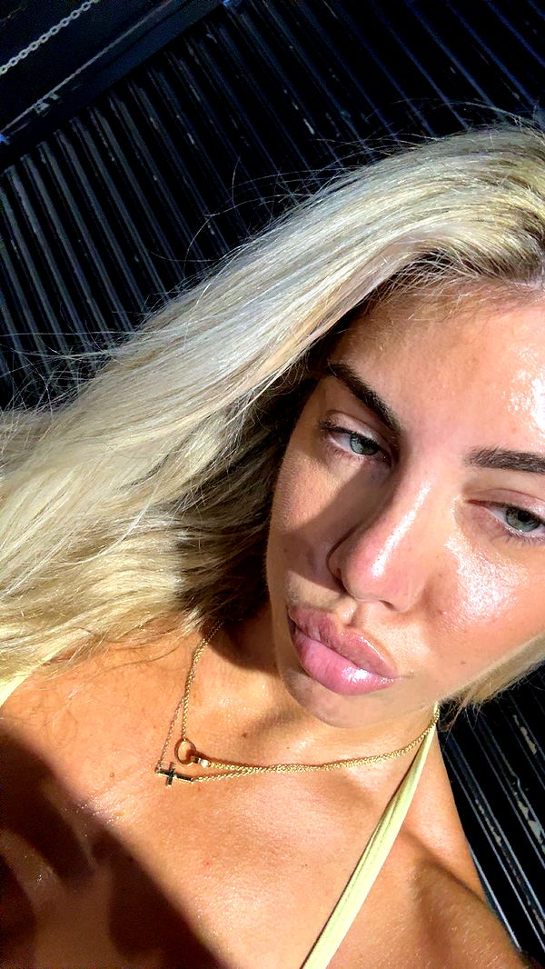 bellarenaldii image ~ Altpins