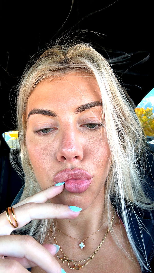 bellarenaldii image ~ Altpins