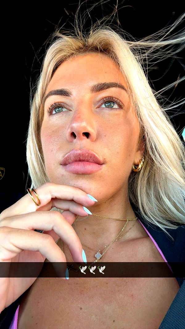 bellarenaldii image ~ Altpins