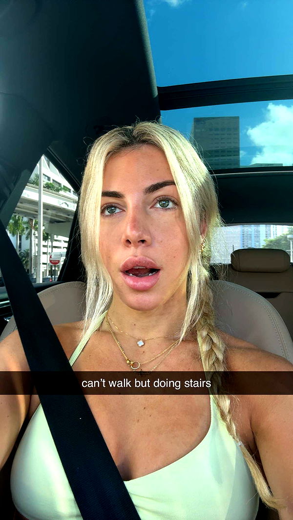 bellarenaldii image ~ Altpins