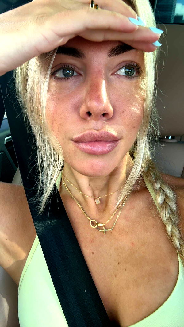 bellarenaldii image ~ Altpins